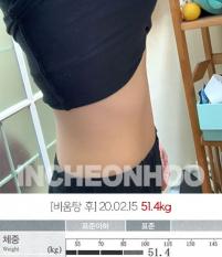 치료 후