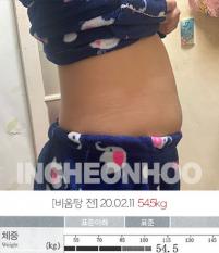 치료 전