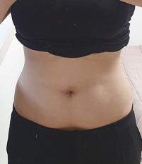 치료 후