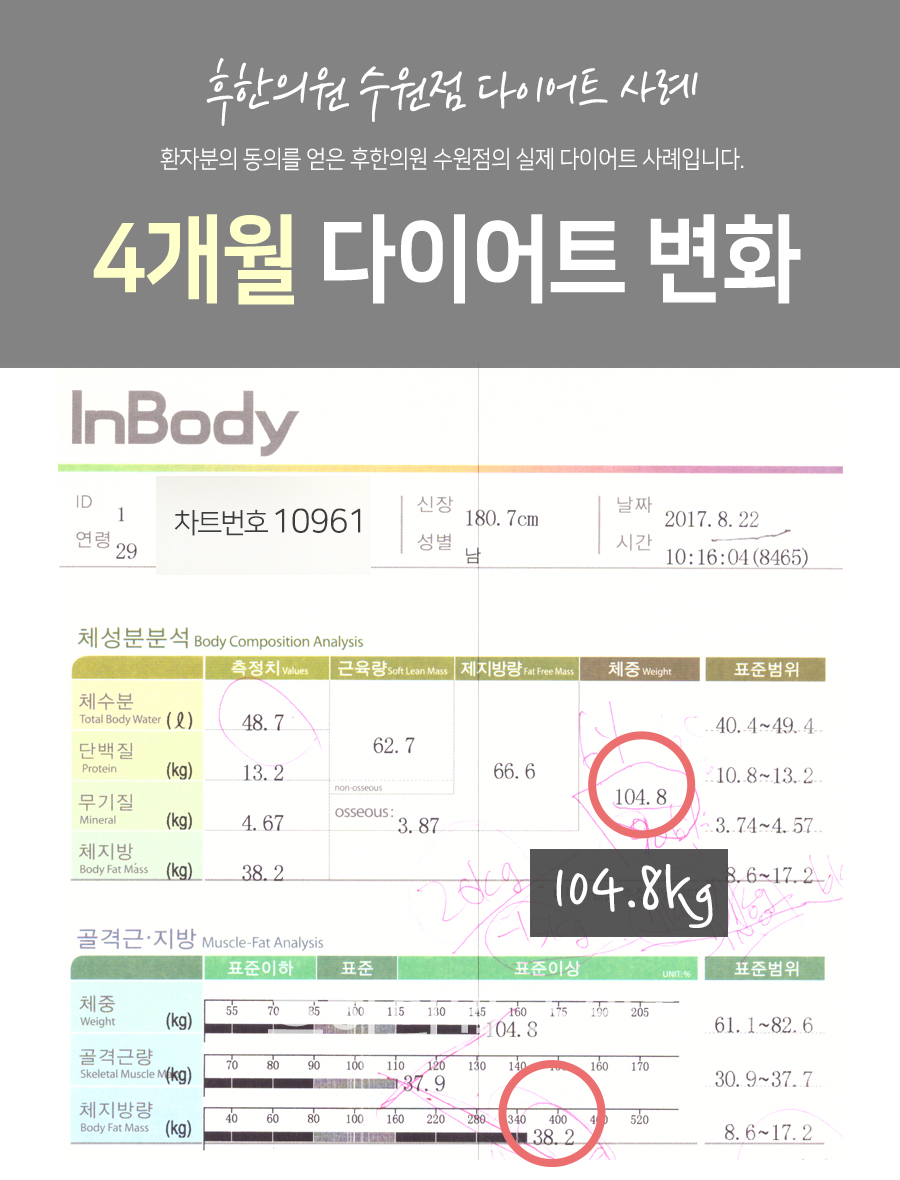 치료 전
