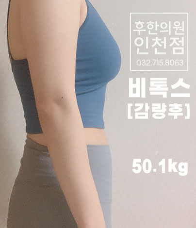 치료 후