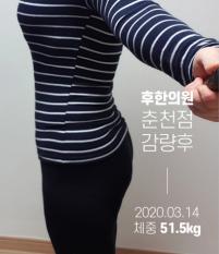 치료 후