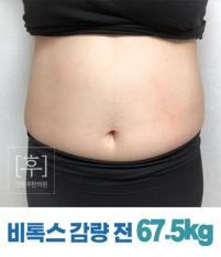 치료 전
