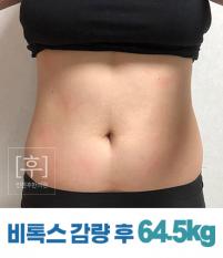 치료 후