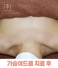 치료 후