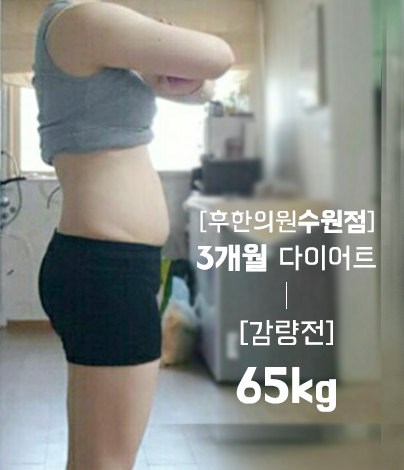 치료 전