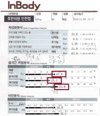 치료 전