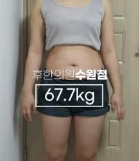 치료 전