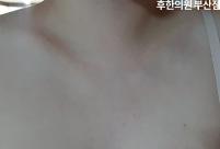 치료 후