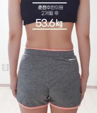 치료 후
