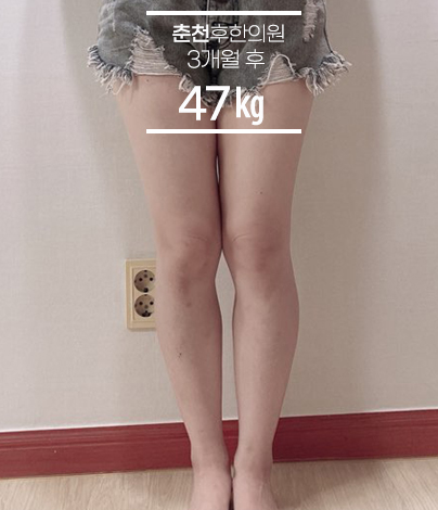 치료 후