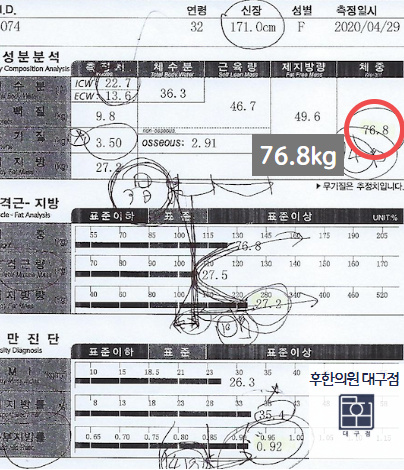 치료 전