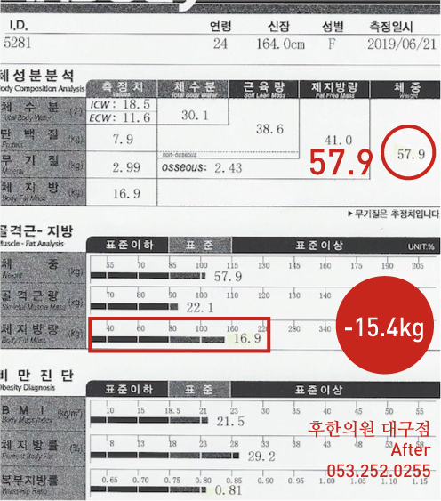 치료 후
