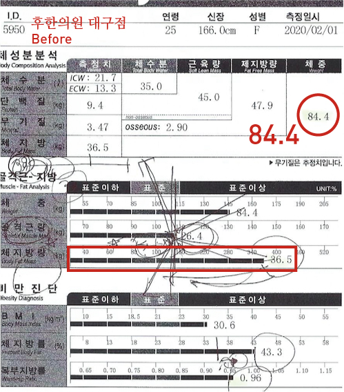 치료 전