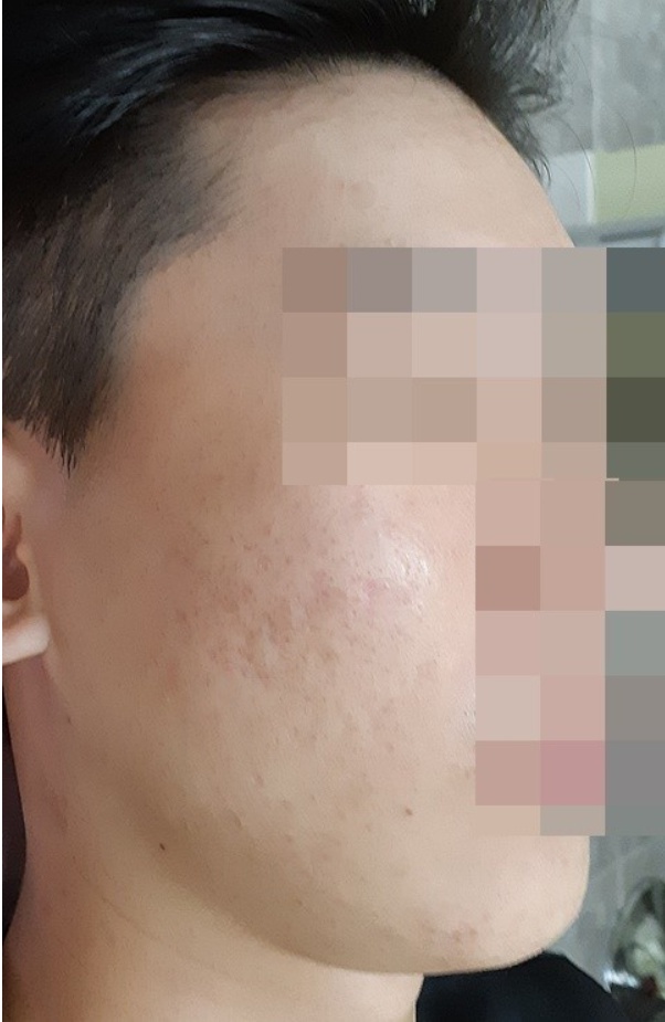 치료 후