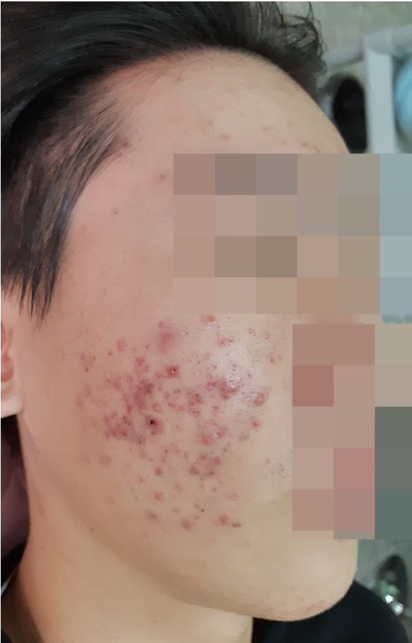 치료 전
