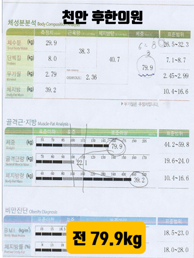 치료 전
