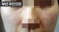 치료 전