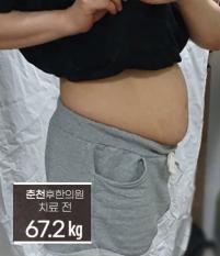 치료 전