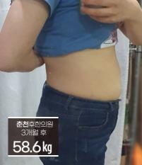치료 후