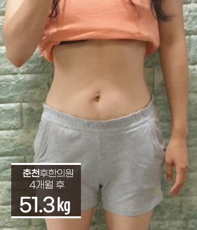 치료 후