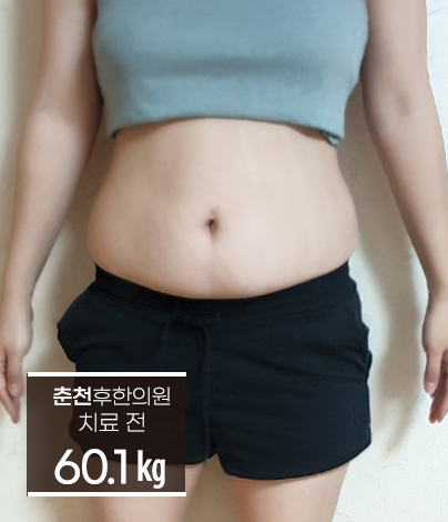치료 전