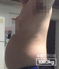 치료 전