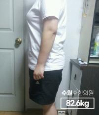 치료 전
