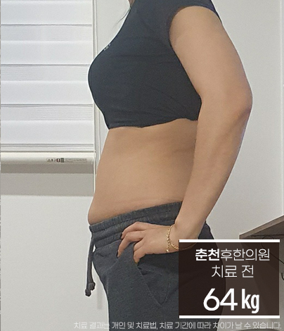 치료 전