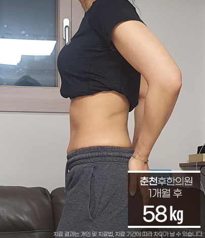 치료 후