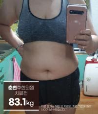 치료 전
