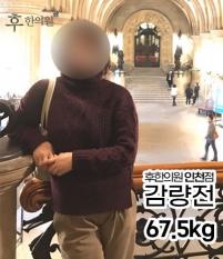 치료 전