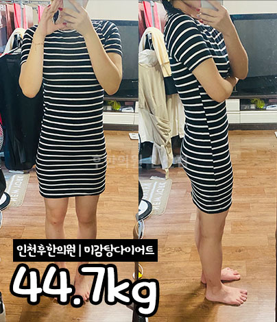 치료 후