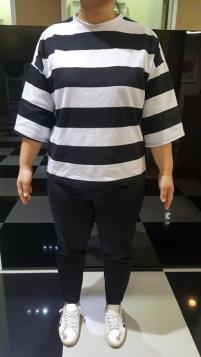 치료 전