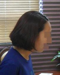 치료 전