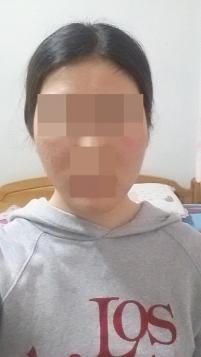 치료 후