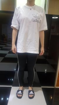 치료 후