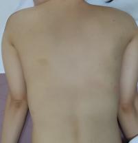 치료 후