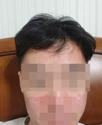 치료 전