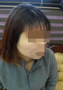 치료 전