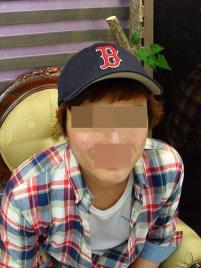 치료 전