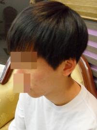 치료 전