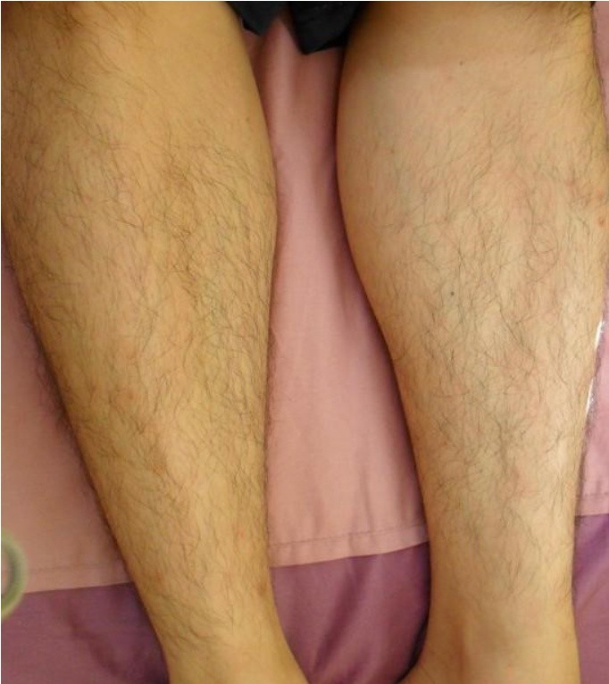치료 후