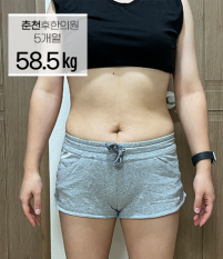 치료 후