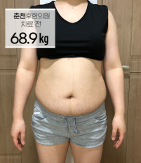 치료 전