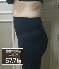 치료 전