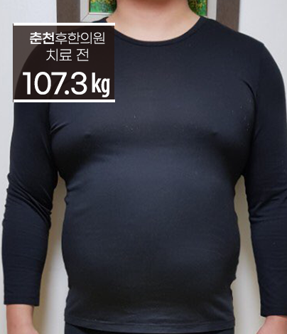 치료 전