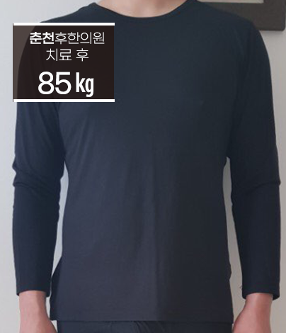 치료 후