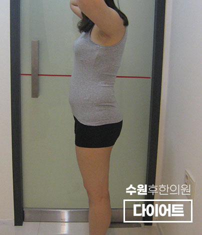치료 전