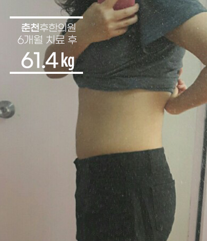치료 후